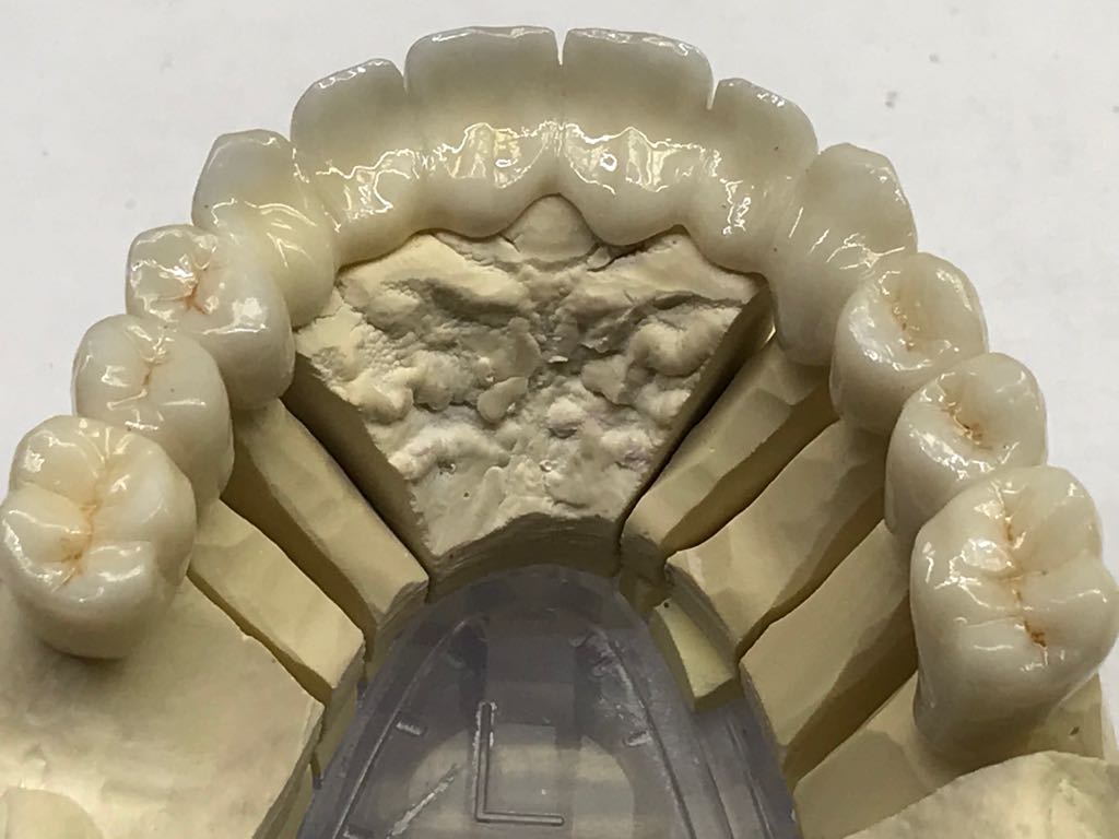 ¿Qué material es la zirconia?
