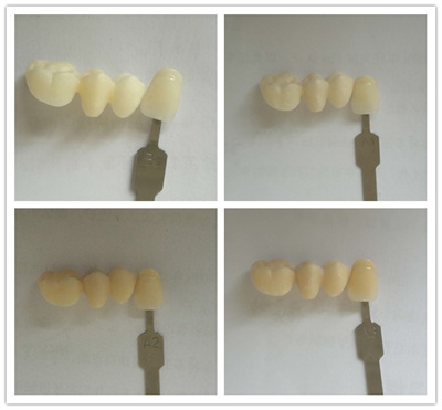 white zirconia block(图3)