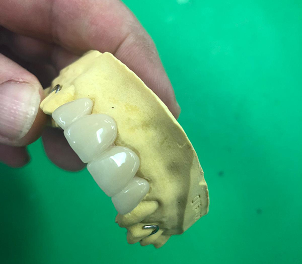 PMMA Dental Material factory(图1)