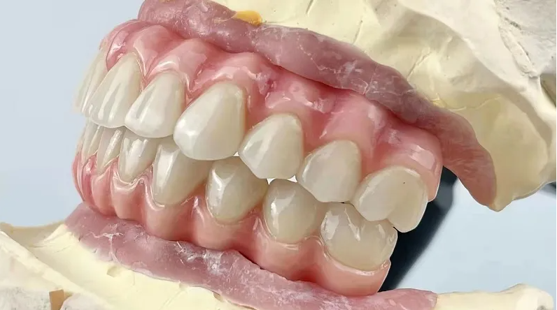 Unique Benefits of Zirconium and Zirconia Crowns