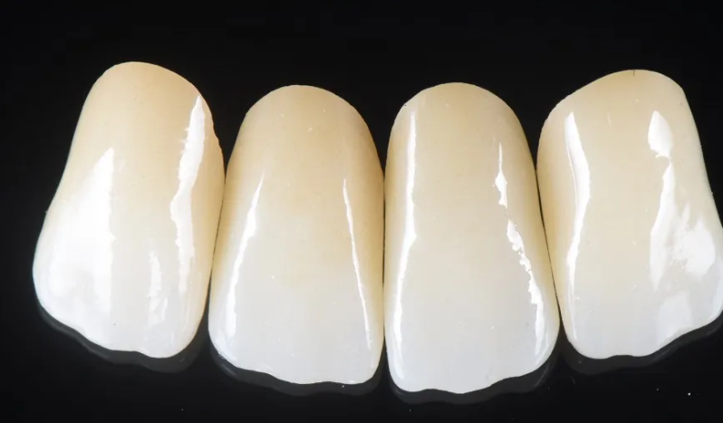 Unique Benefits of Zirconium and Zirconia Crowns(图3)