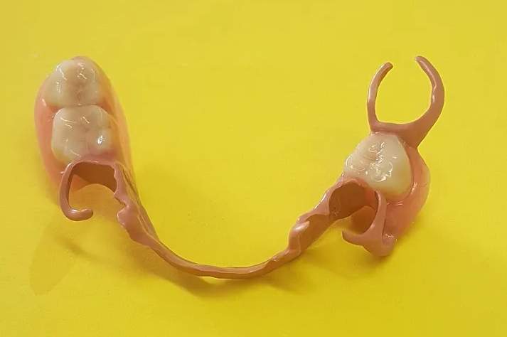 Problems, Causes and Solutions of Full Denture Fabrication(图2)