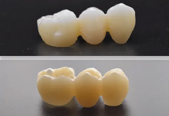 Problems, Causes and Solutions of Full Denture Fabrication(图3)