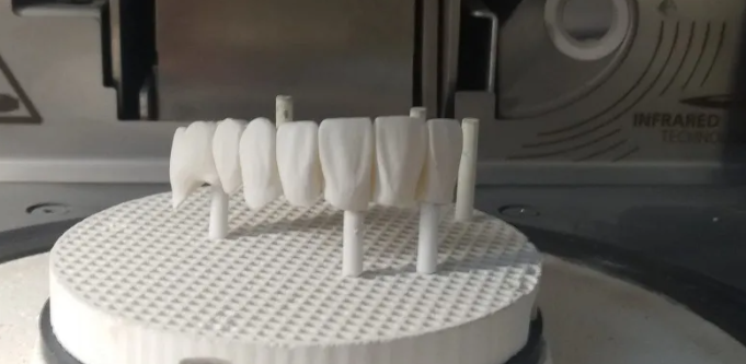 Problems, Causes and Solutions of Full Denture Fabrication(图4)