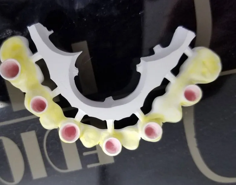 Most Common Concerns about Zirconia Porcelain Teeth(图2)