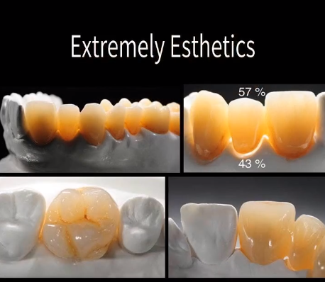 The Benefits of Multilayer Zirconia Crowns:(图2)