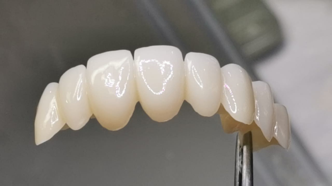 4D pro multilayer zirconia blocks(图2)