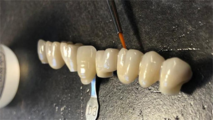 Análisis de los factores que afectan el color de los dientes de Zirconia total
