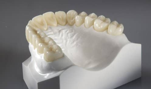 ¿Quién es el mejor laboratorio de desarrollo de coronas de zirconia?