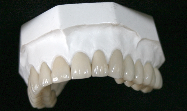 Aprenda más sobre la zirconia dental