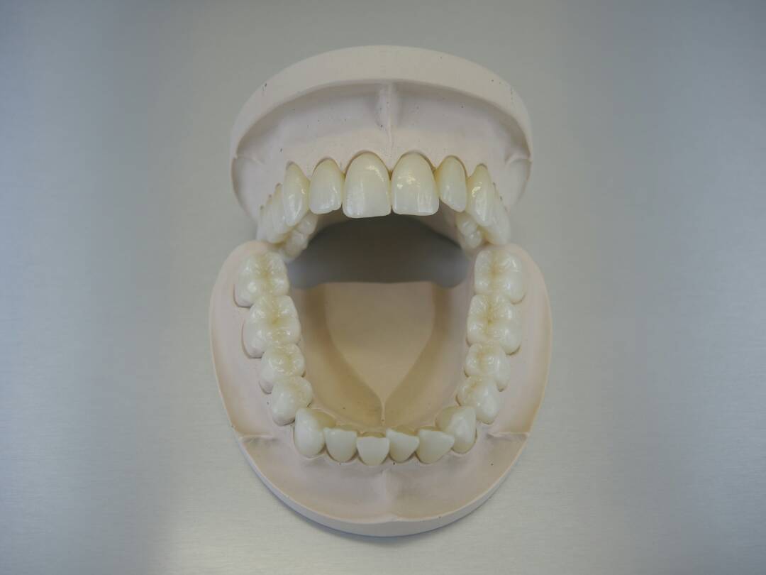 Ultra Translucent Zirconia(图1)