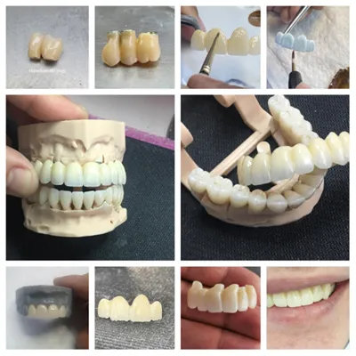 Multilayer Zirconia: 1200MPA 4D PLUS Dental Zirconia Blocks(图4)