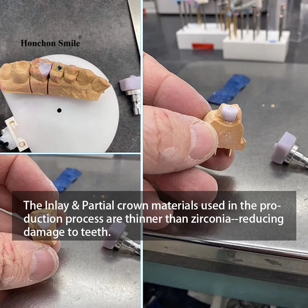 Lithium Disilicate in Dentistry: Strength, Aesthetics & Applications(图3)