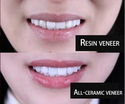 basic knowledge and common sense of the oral industry