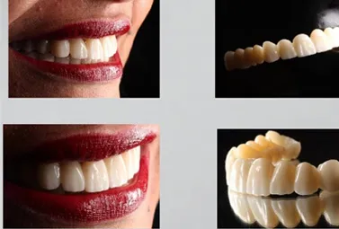 3D multilayer zirconia(图2)