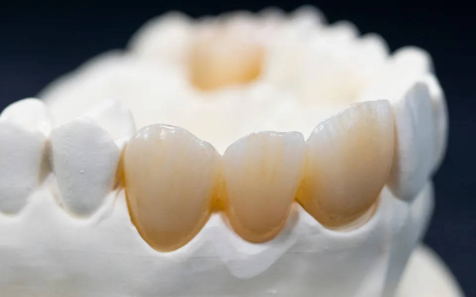 ST multilayer zirconia block(图1)
