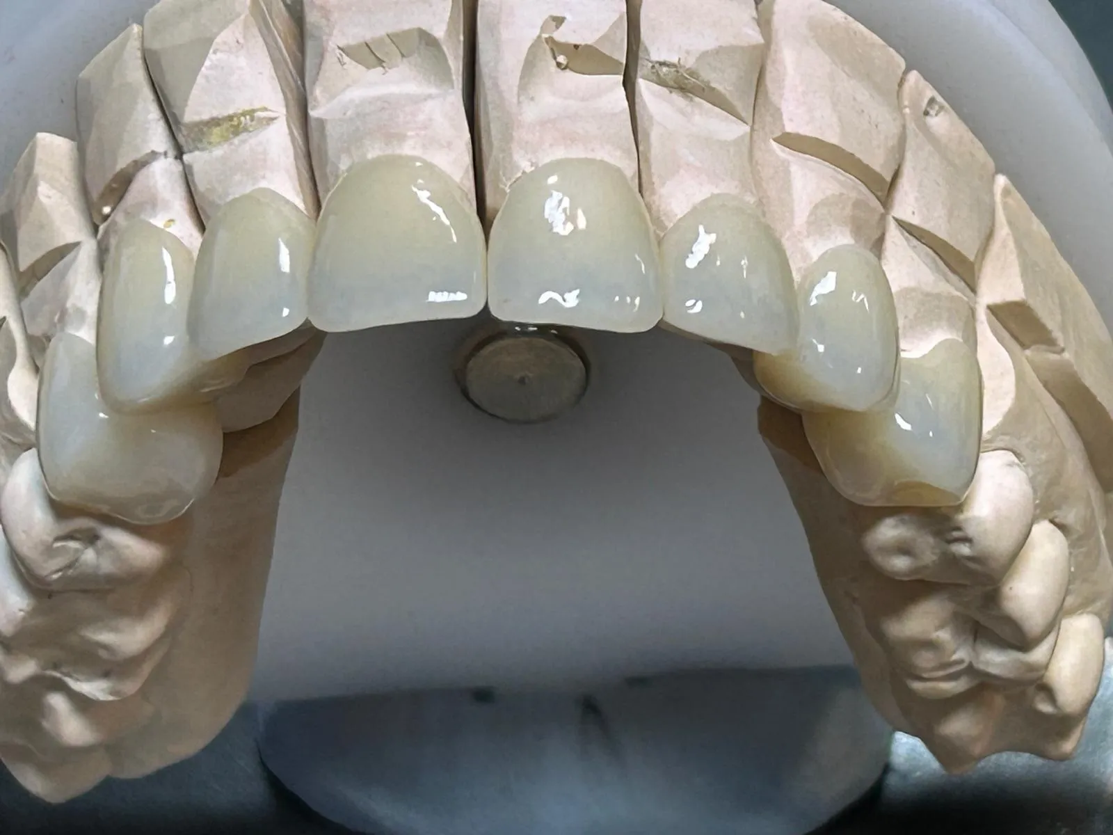 Bloc de zircone multicouche esthétique(pic3)