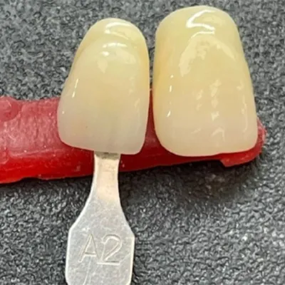  Multi-Layer Gradient Zirconia Blocks — Combining Functionality and Aesthetics(图2)